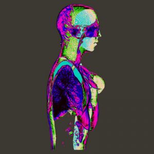 X-ray-aurore-2