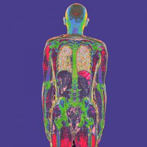 X-ray-stephane-back