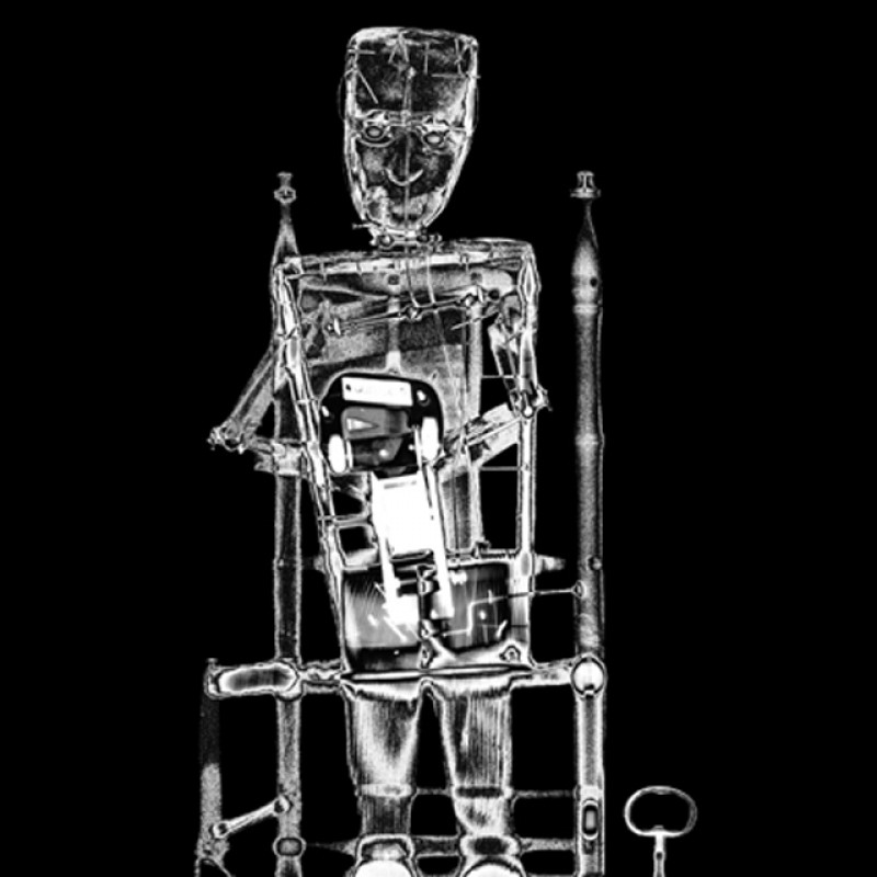 X-ray-tricoteuse-face